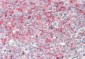 CD1D Antibody